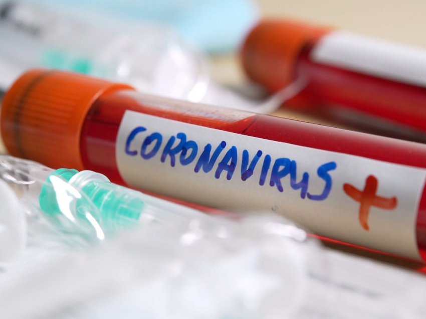 Bie numri i viktimave në Itali, mbi 20 mijë të infektuar me COVID-19