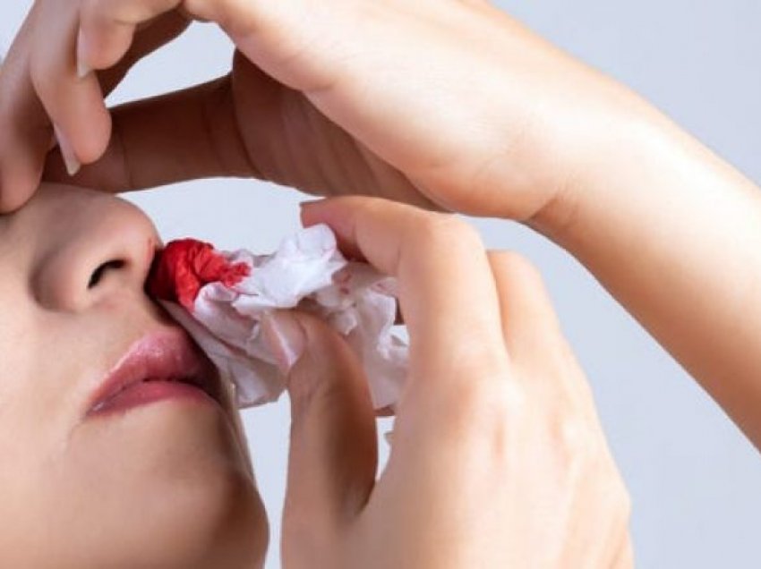Shkaqet më të shpeshta të gjakderdhjes nga hunda