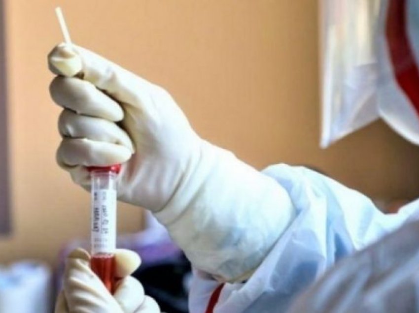 Shqipëri, gjashtë të vdekur dhe 503 raste të reja me coronavirus