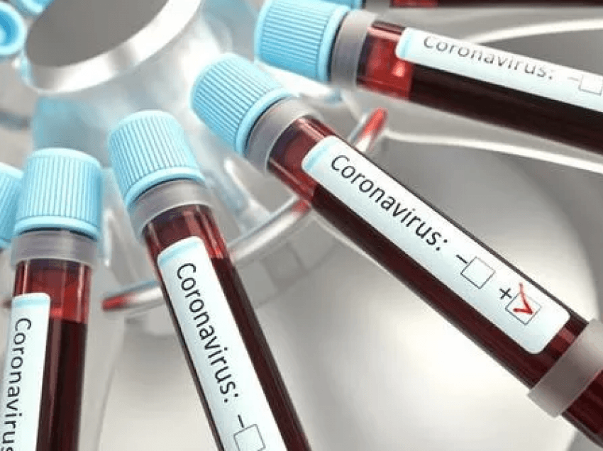 Këto grupe gjaku e vuajnë më shumë virusin COVID-19