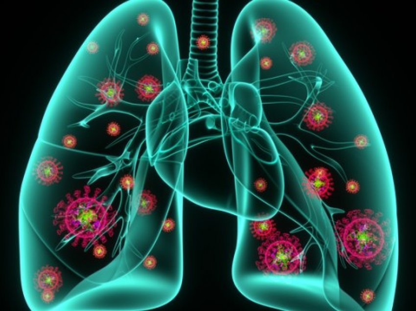 Aktiviteti fizik mund të ndikojë në uljen e rrezikut të vdekshmërisë nga pneumonia