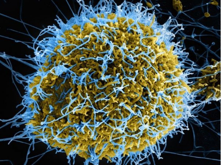 Vdekja e zezë, shkencëtari: Ky virus mund të shkatërrojë botën brenda pak javësh