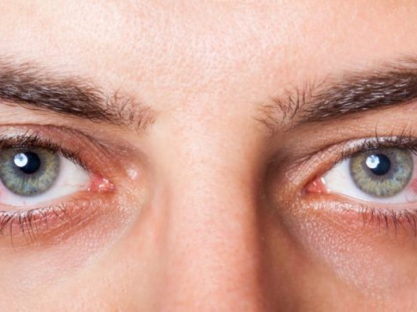 Studimi i ri: Koronavirusi shkakton dëmtim të syve