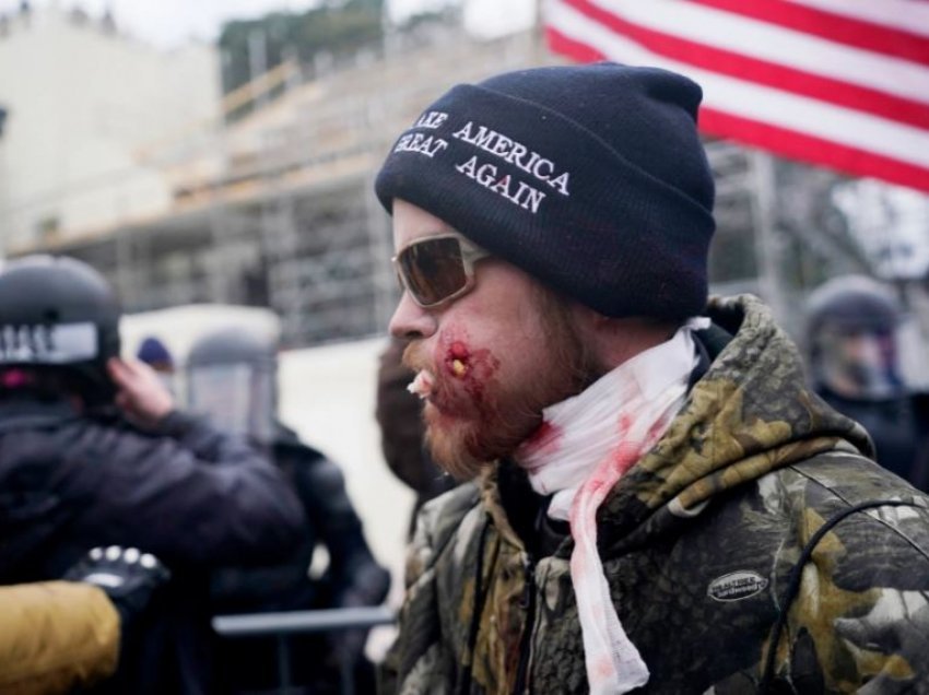 Me fasho të gjakosur, përleshje, e kufoma, këto janë pamjet e rënda nga protesta në SHBA 
