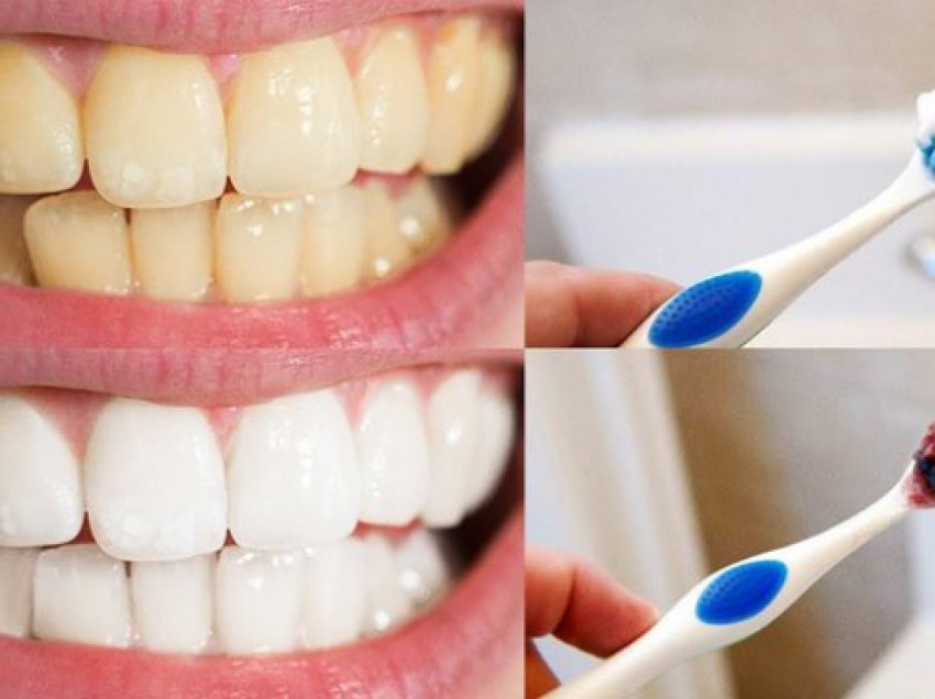 Për dhëmbë të bardhë xixë, ndiqni këto truke të thjeshta