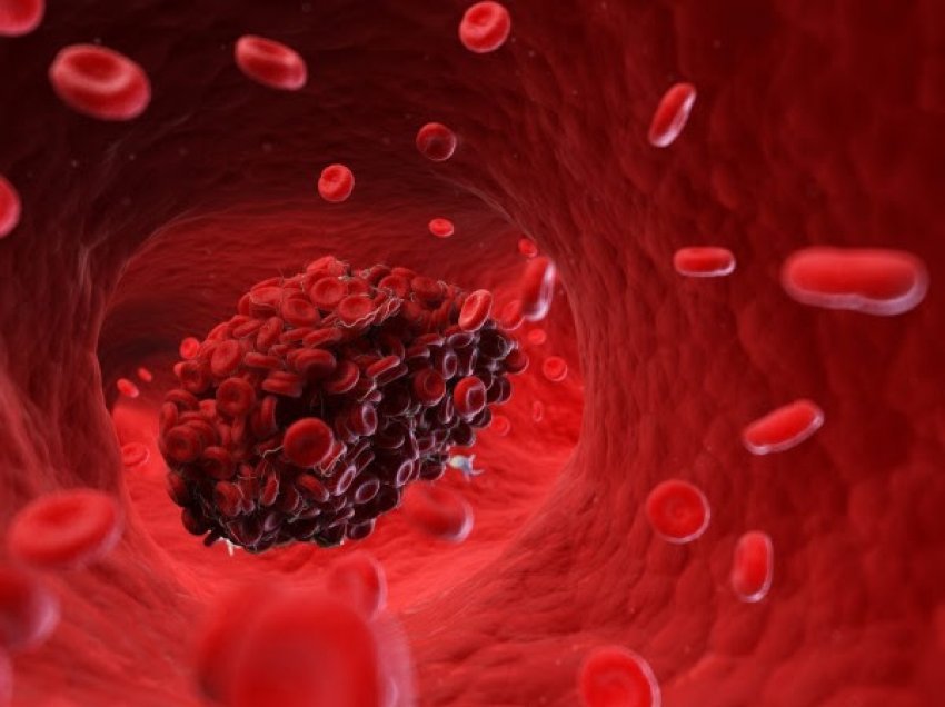 ​EMA rekomandon që heparina të mos përdoret për mpiksje të rralla të gjakut