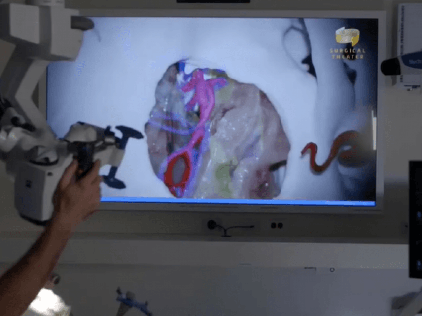 Inovacion i ri në shëndetësi- Teknologjia e cila po i ndihmon shumë kirurgët