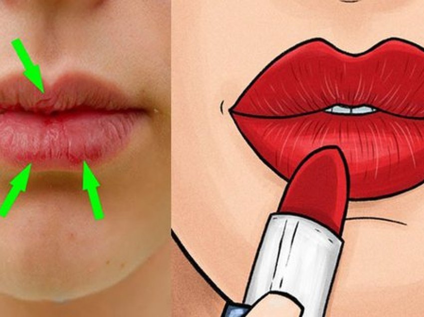 Buzëkuqi nuk është zgjidhja e duhur, vetëm këto 4 produkte natyrale mund të trajtojnë buzët e plasaritura