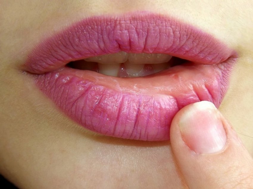 8 gjërat që buzët po ju tregojnë për shëndetin tuaj