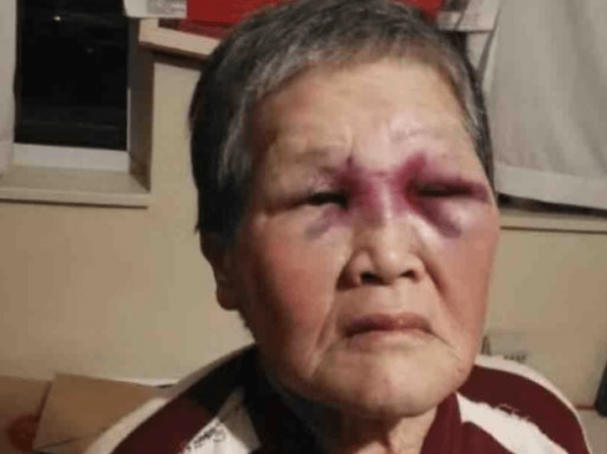 U sulmua në rrugë, gjyshja 75 vjeçare do të dhurojë 1 milion dollarë për të luftuar racizmin