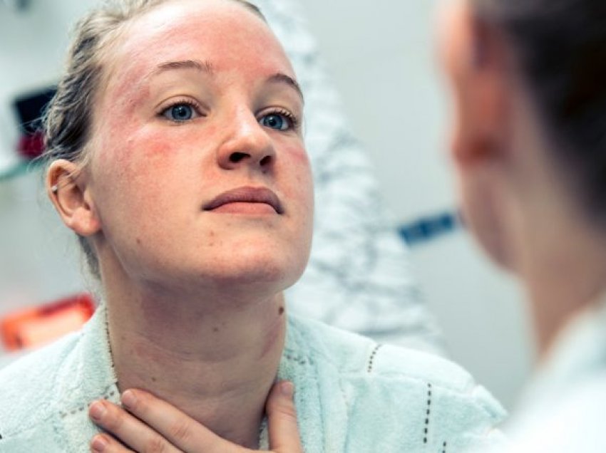 Këshilla e dermatologut: Perimet e gjelbra lehtësojnë inflamacionin dhe skuqjen në fytyrë
