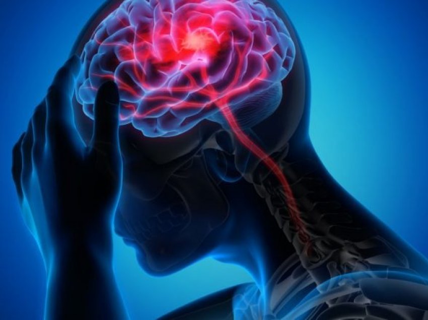 Fazat e migrenës që bëjnë dallimin nga një dhimbje e zakonshme