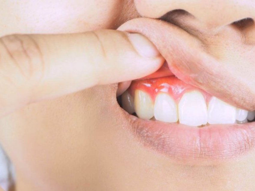 Problemi i gojës mund të jetë duke rritur rrezikun e sëmundjes vdekjeprurëse