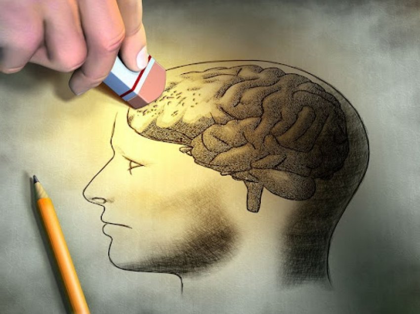 Si zhvillohet sëmundja Alzheimer në tru?
