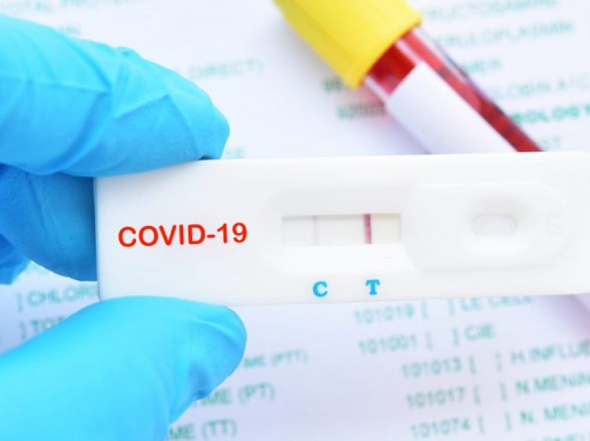 Ndalohen dy persona për falsifikim të testeve të Covid-19