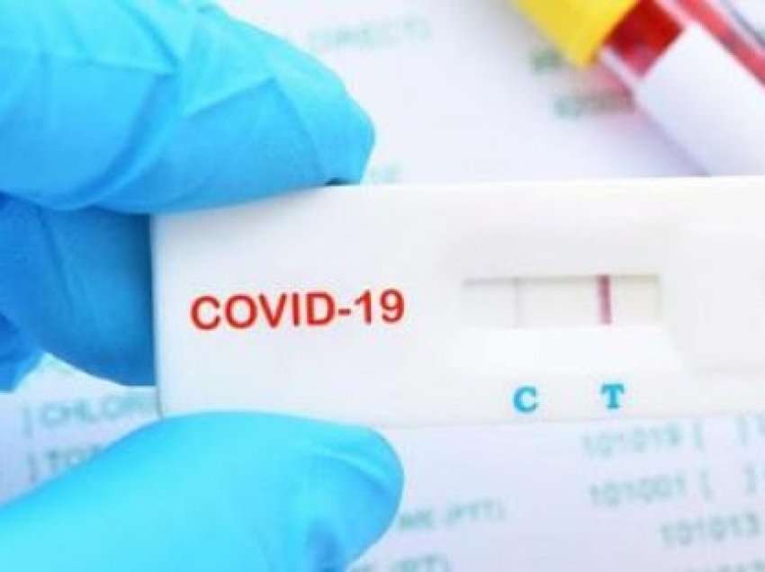 ​53 raste të reja me COVID-19 në Shqipëri