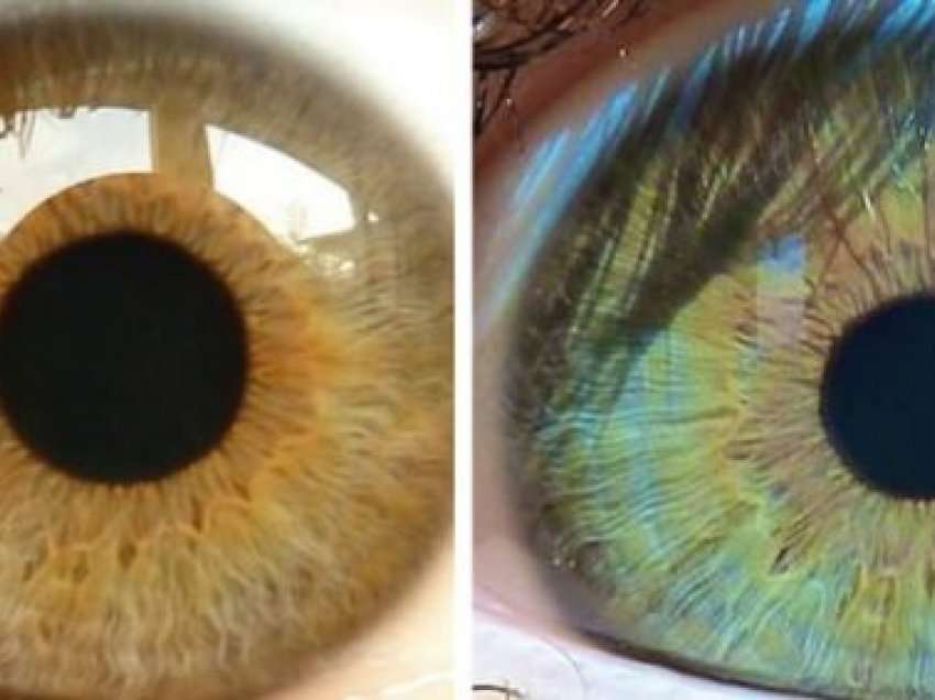 5 faktorët që ndikojnë në ndryshimin e ngjyrës së syve