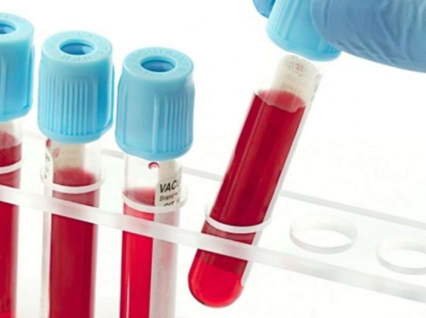 Testi i gjakut mund të diagnostikojë saktë këtë lloj kancer