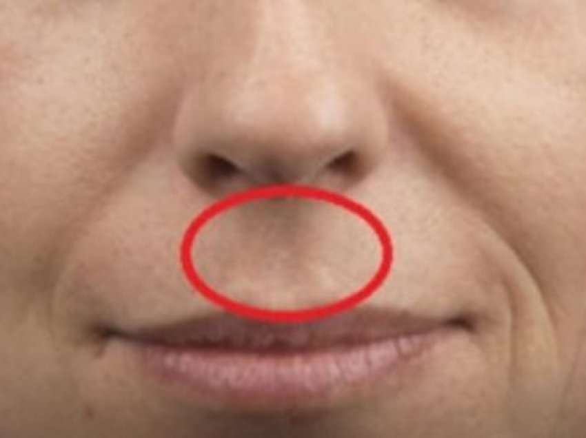 Çfarë do të thotë të keni këtë gropë midis hundës dhe buzës së sipërme?