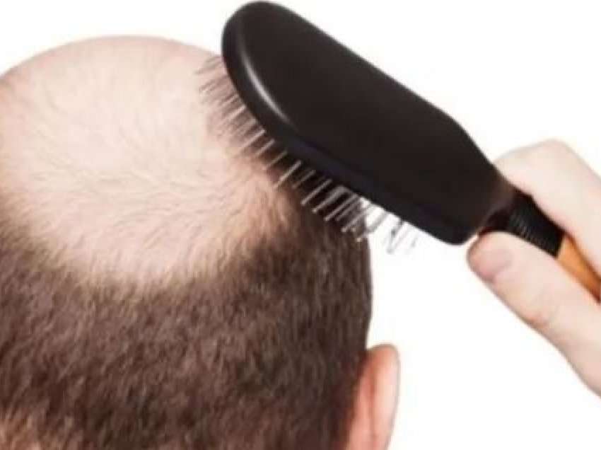 Trajtime natyrale kundër rënies së flokëve