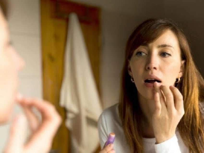 Si të parandaloni tharjen dhe plasaritjen e buzëve gjatë dimrit?