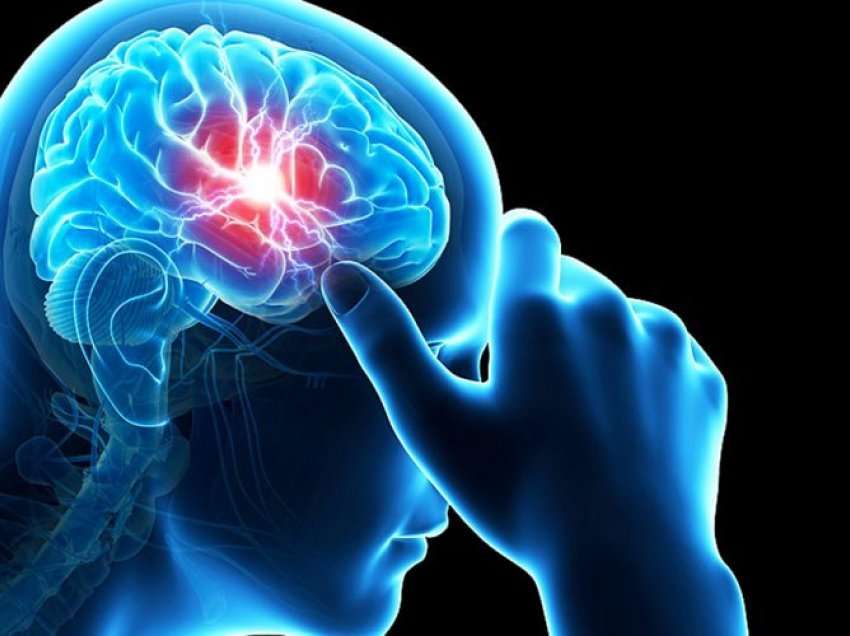 Llojet e rralla të dhimbjes së kokës, arsyet shëndetësore pse ndodhin
