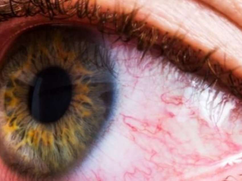 Sytë mund të zbulojnë se si është gjendja juaj shëndetësore