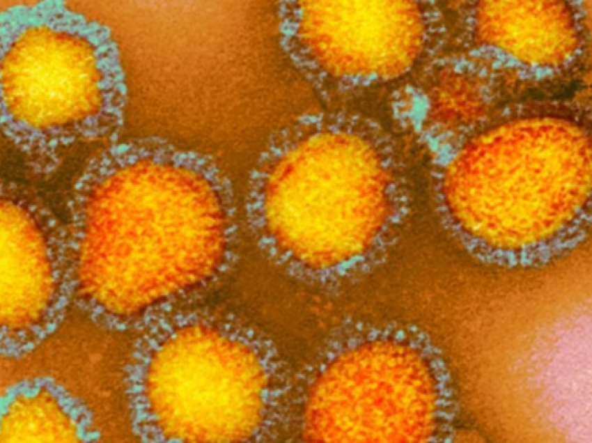 ‘Gripi rus’ i 130 viteve më parë mund të ketë qenë një koronavirus, thonë shkencëtarët