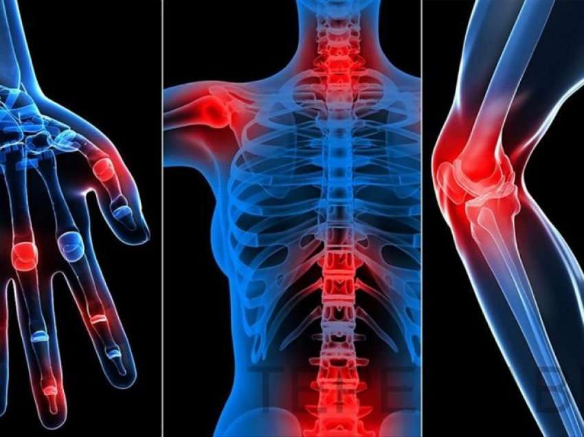 Artriti dhe artralgia, sëmundjet që dëmtojnë kyçet dhe nyjat