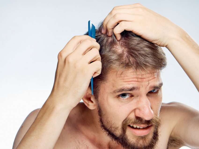 Pse meshkujve u bien flokët: testosteroni nuk ka të bëjë, ja shkaqet dhe mjetet e mundshme