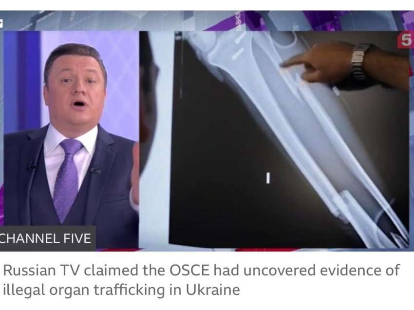 Propaganda ruse nuk ka të ndalur, akuzon Ukrainën për trafikim organesh 