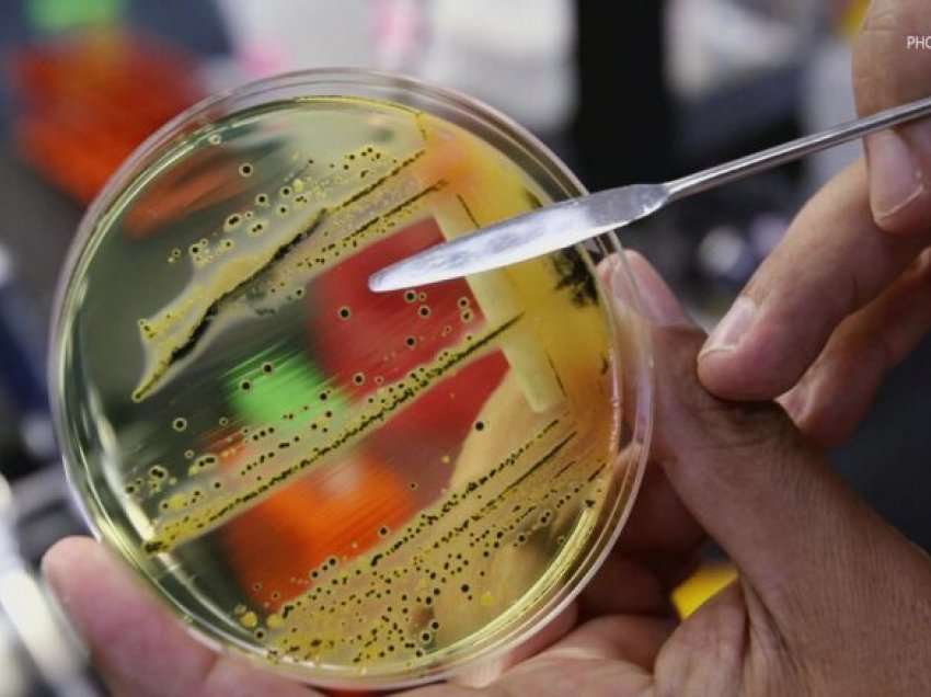 Si ta luftoni bakterin “Escherichia coli”?