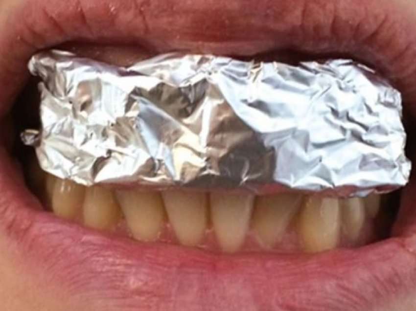 Nuk ka asnjë efekt anësor, metoda me letër alumini për zbardhjen e thjeshtë të dhëmbëve