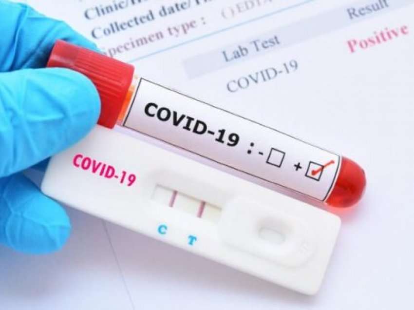 Nga 71 testime, vetëm një rast pozitiv me COVID-19 në Kosovë