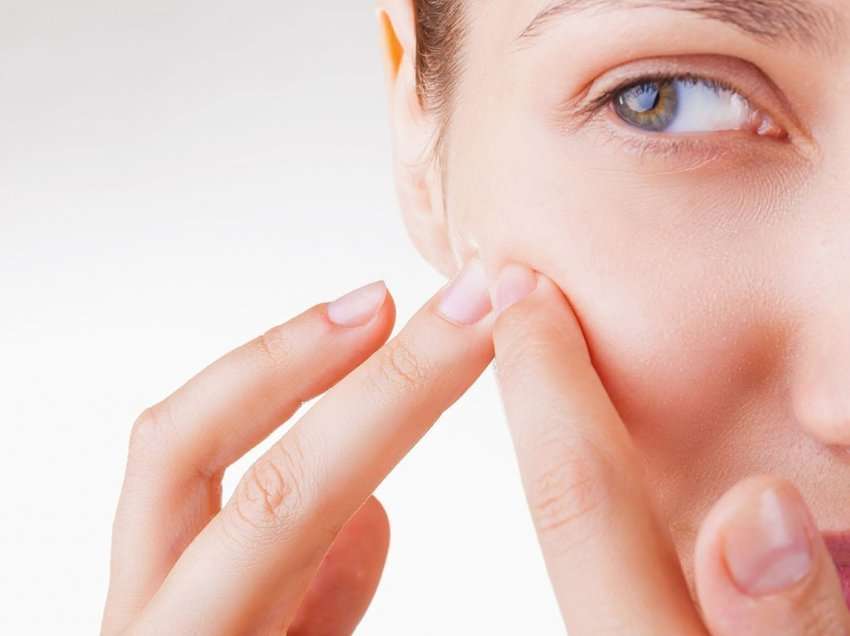 Çfarë i shkakton aknet në disa pjesë të fytyrës suaj dhe çfarë tregojnë ato zona?