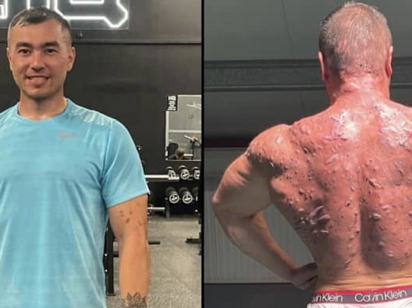 Mbeti 9 muaj në shtëpi, bodybuilder-i tregon pasojat e steroideve në trupin e tij