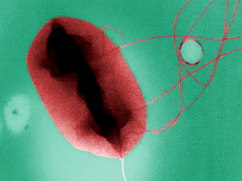 Mbi 500 mijë vdekje nga bakteret “vrasëse” në Europë