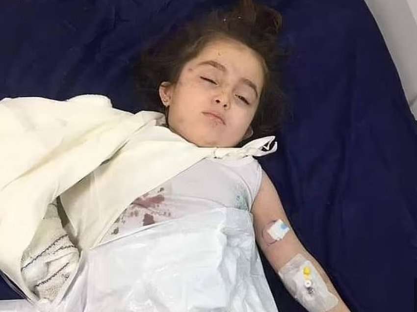 Ariu ia kafshon krahun vajzës trevjeçare në Irak