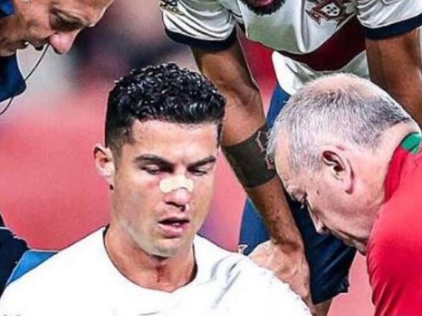 Dëmtim i frikshëm për Ronaldon