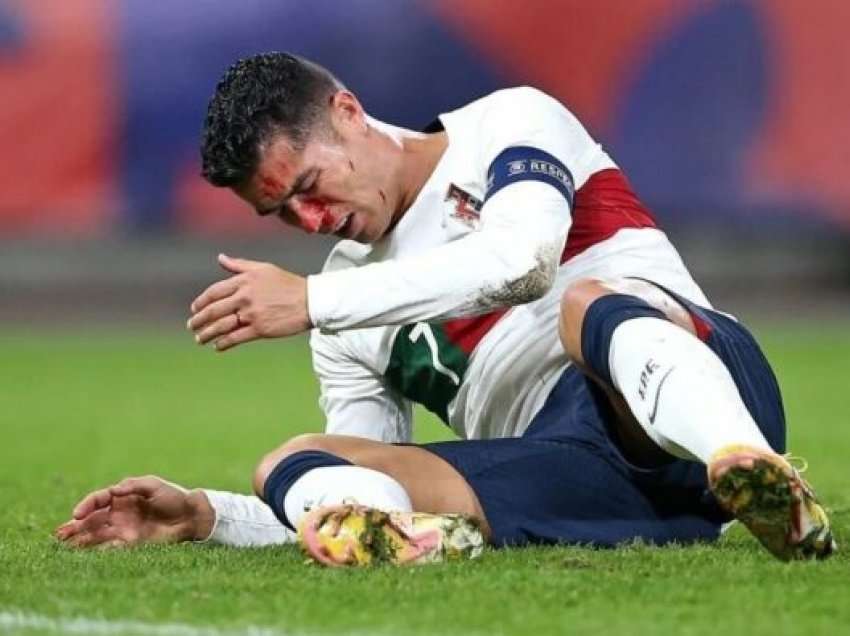 Ronaldo, portieri çek i thyen hundën në fushë