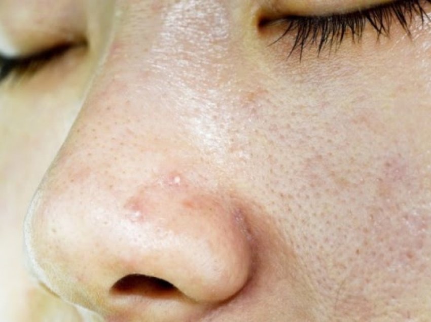 Këto janë dëmet që mund t'i shkaktoni fytyrës nëse flini me grim