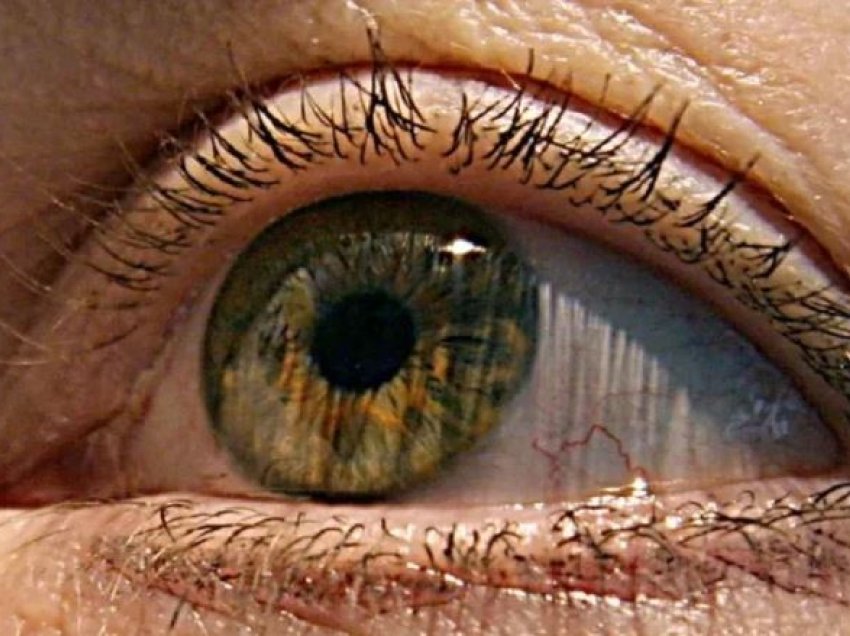 Shenjat e para të Alzheimerit mund të shfaqen në sytë tuaj, zbulon studimi