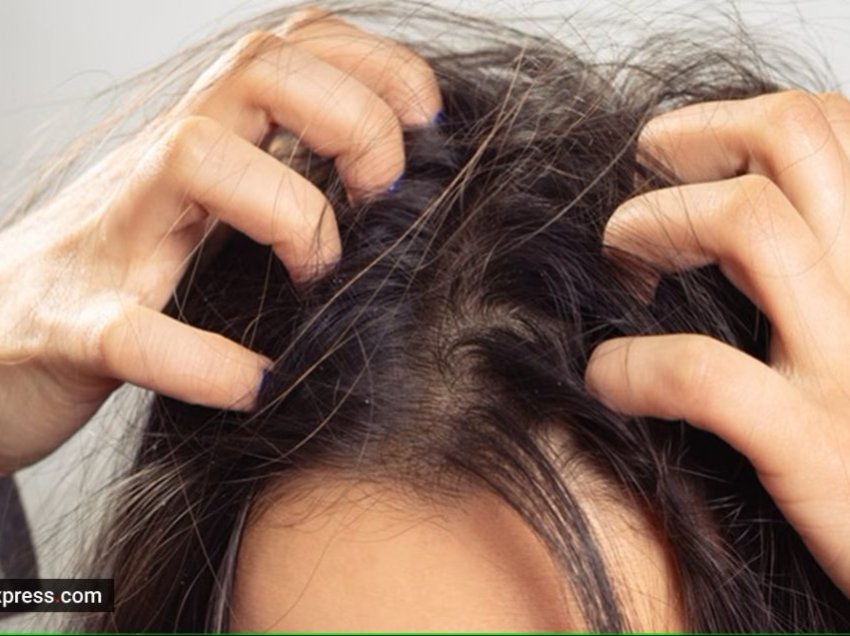 A mund të ndikojnë flokët e ndotur në shfaqjen e akneve? Parukierja e njerëzve të famshëm zbulon të vërtetën