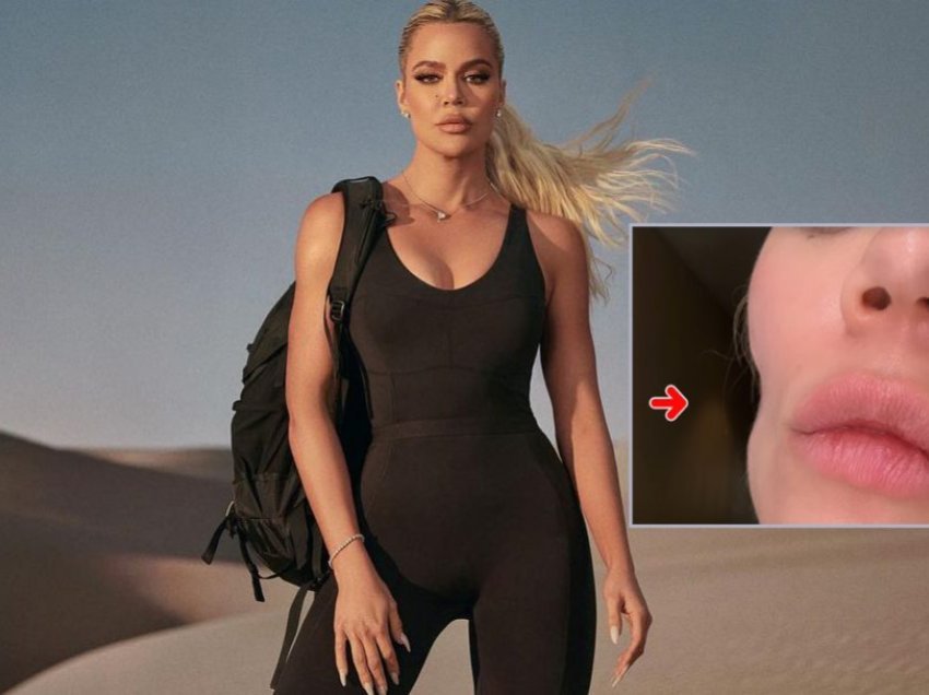 Khloe Kardashian tregon fytyrën pas operacionit për heqjen e një forme të kancerit të lëkurës