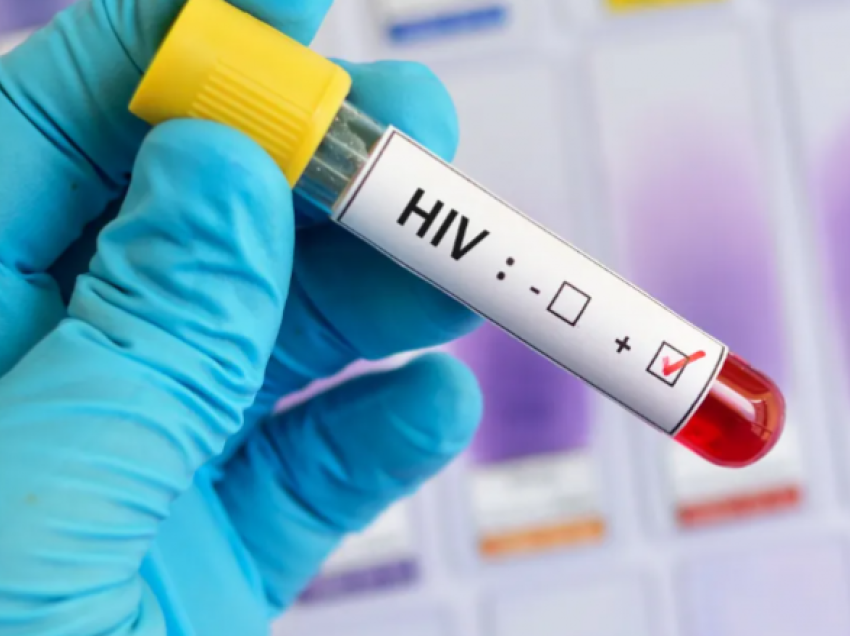 Shkencëtarët janë shumë afër kurës për trajtimin e HIV-it