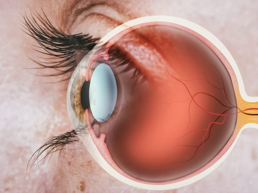 Problemet me sytë – A e dini se edhe sytë digjen nga dielli? Çfarë duhet bërë